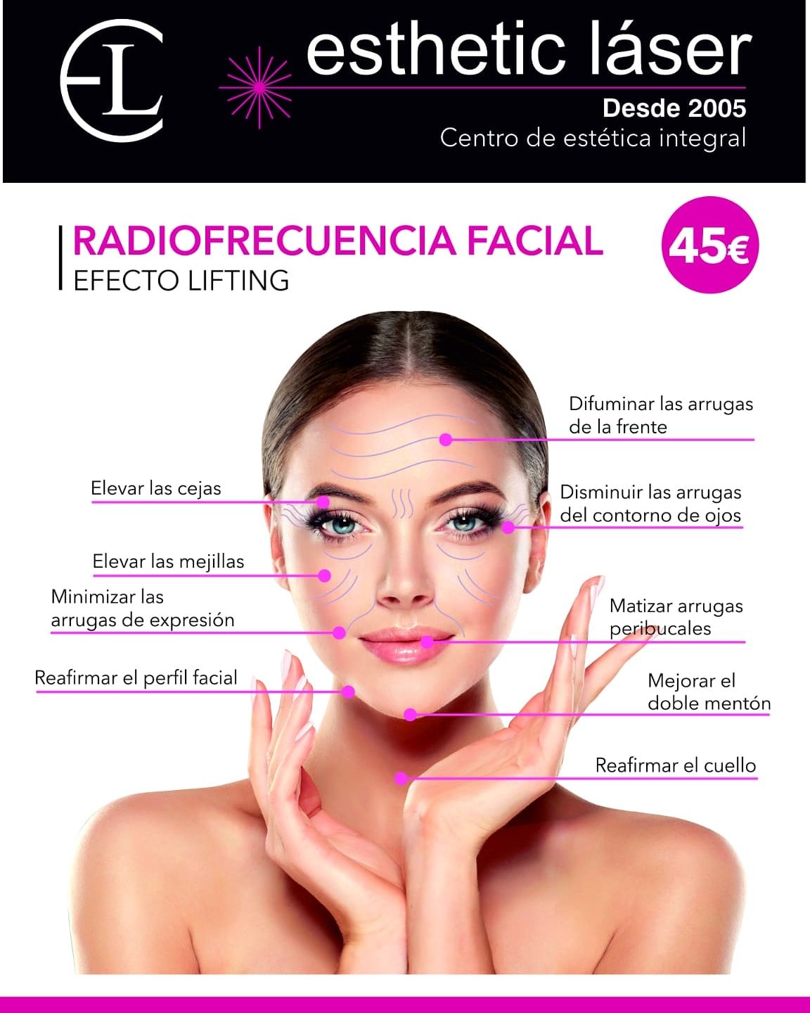 Radiofrecuencia Facial