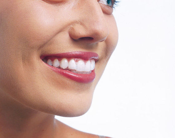 Invisalign, sus ventajas.: Servicios de Clínica Dental Dr. Ignacio Belsué Invisalign, sus ventajas.: Servicios de Clínica Dental Dr. Ignacio Belsué