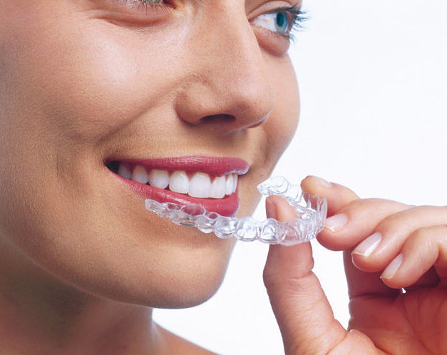 Invisalign, ¿qué es?: Servicios de Clínica Dental Dr. Ignacio Belsué Invisalign, ¿qué es?: Servicios de Clínica Dental Dr. Ignacio Belsué