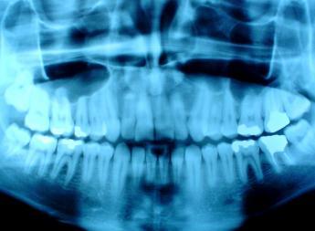 RAYOS X DIGITAL: SERVICIOS de Clínica Dental Basauri