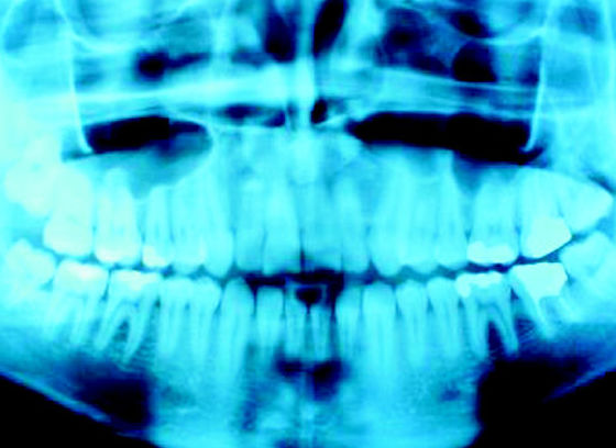 Dental Basauri