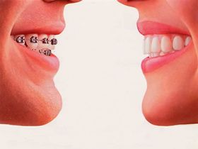 ORTODONCIA: SERVICIOS de Clínica Dental Basauri