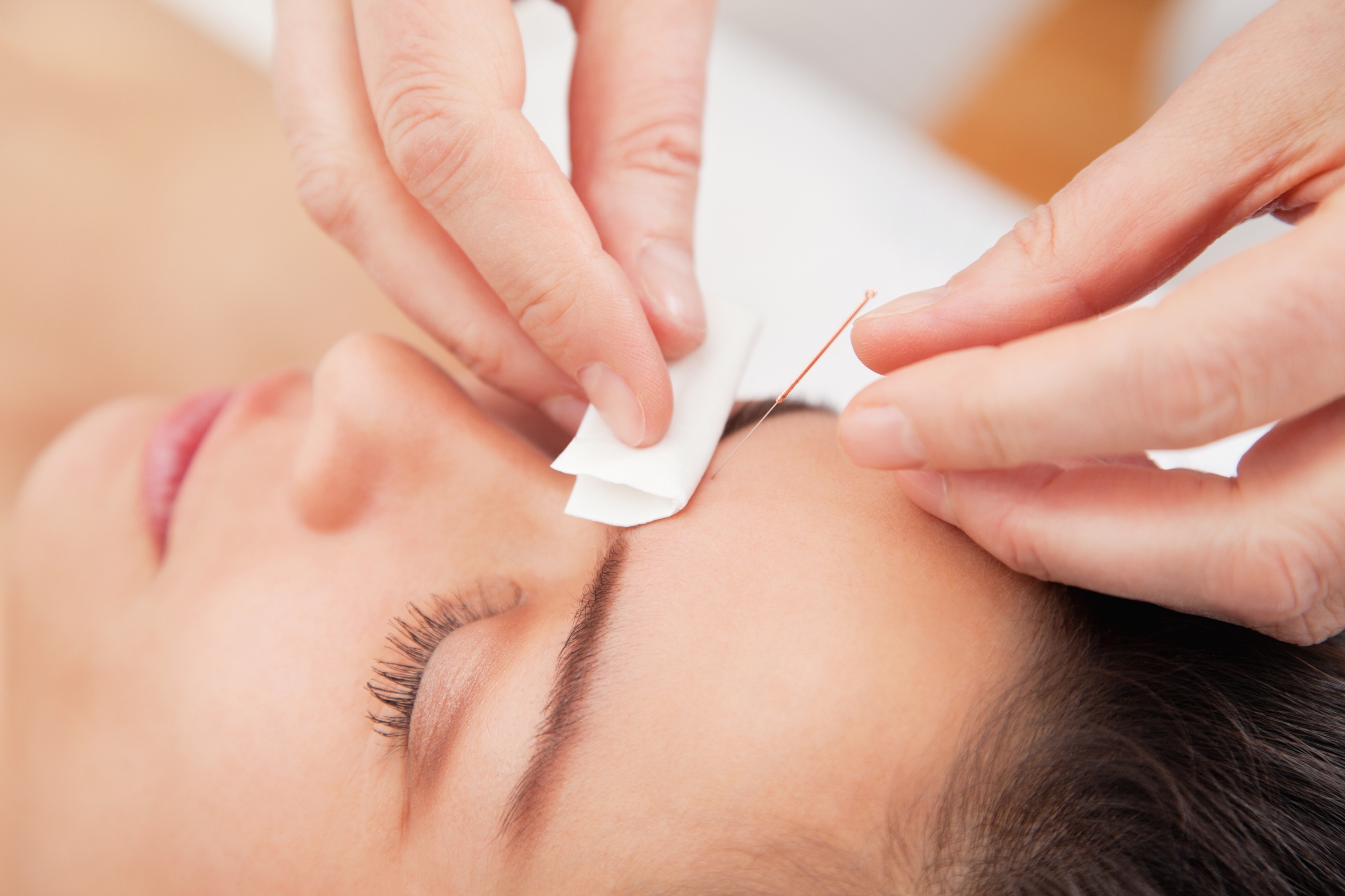 Acupuntura para la pérdida de peso y remodelación corporal: Cursos Consultas de Escuela de Salud PNA Acupuntura para la pérdida de peso y remodelación corporal: Cursos Consultas de Escuela de Salud PNA