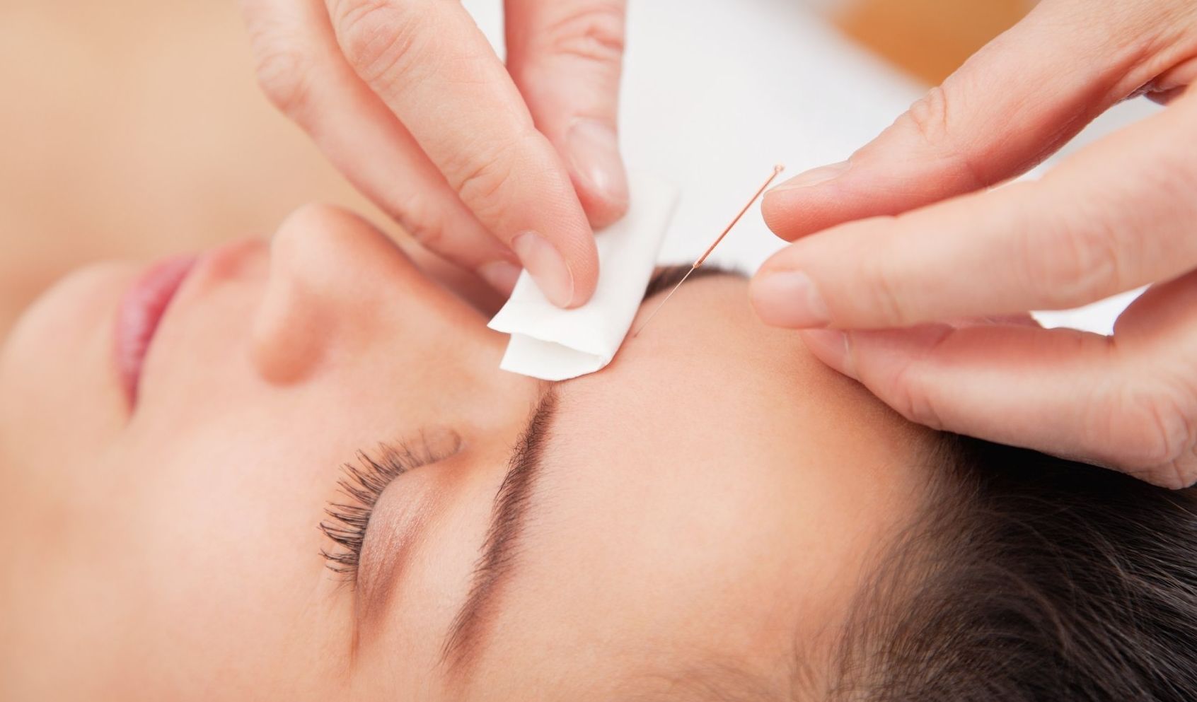 Acupuntura Aplicada a la Estética Facial & Corporal: Cursos Consultas de Escuela de Salud PNA Acupuntura Aplicada a la Estética Facial & Corporal: Cursos Consultas de Escuela de Salud PNA