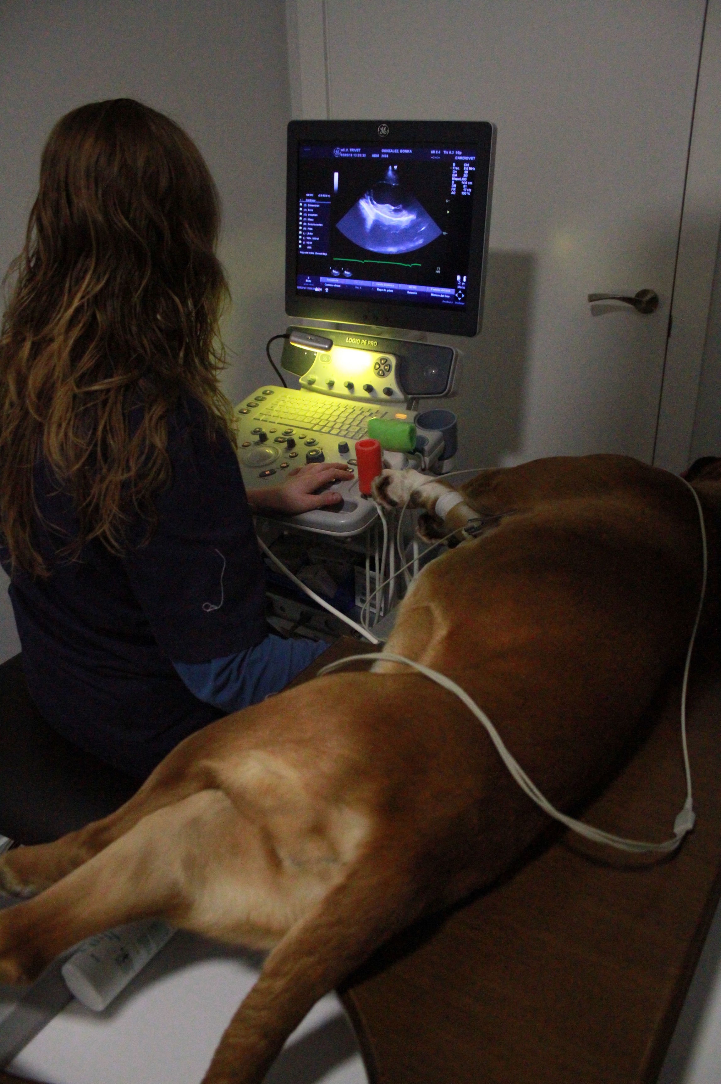 ECOCARDIOGRAFÍA ECOCARDIOGRAFÍA