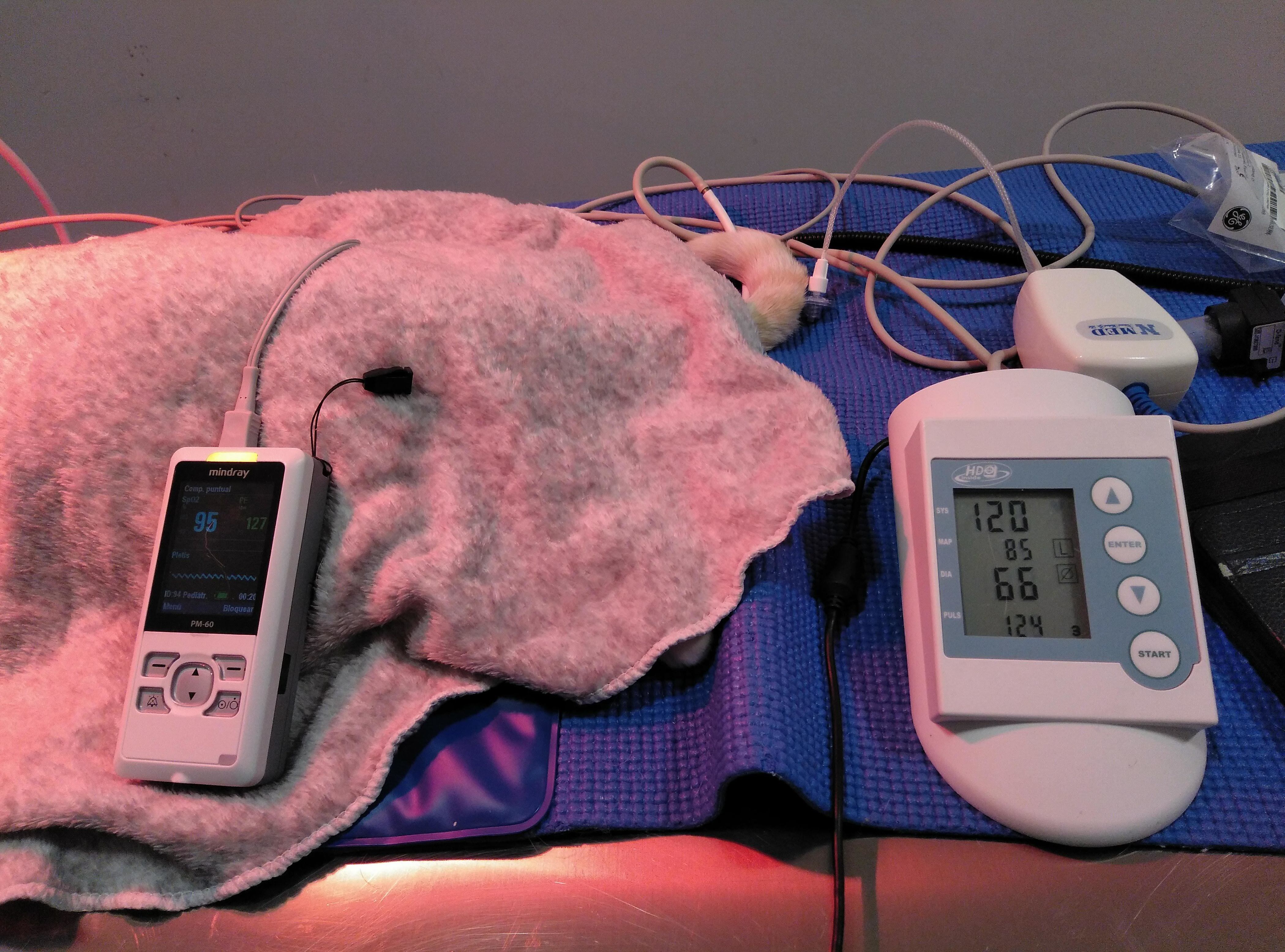 Monitorización (pulsioximetria y presión arterial) Monitorización (pulsioximetria y presión arterial)