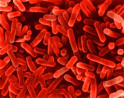 Bacterias rojas Bacterias rojas
