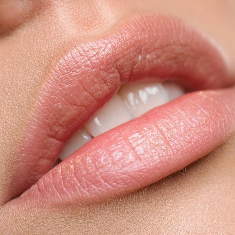 RELLENO DE LABIOS EN RIVAS RELLENO DE LABIOS EN RIVAS