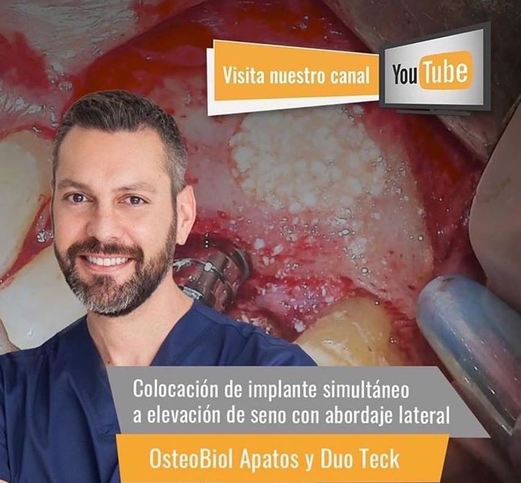 DR. CARLOS MARTÍNEZ -CANAL YOUTUBE, OSTEBIOL, ELEVACIÓN DE SENO II