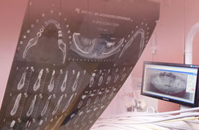 Radiología dental digital : Servicios de Clínica Dental Reina Victoria 23