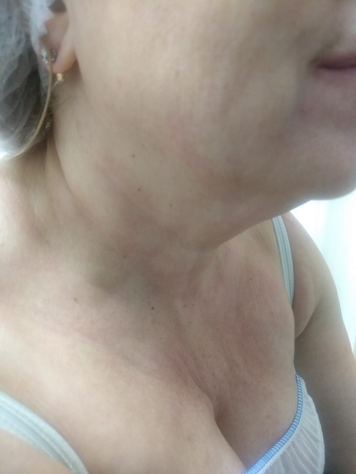 Antes Antes
