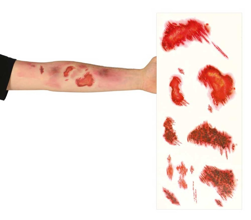 Tatuajes abrasiones Tatuajes abrasiones