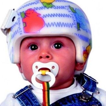 Casco corrector  para bebés: Productos y servicios de Ortopedia Delgado, S. L. }}