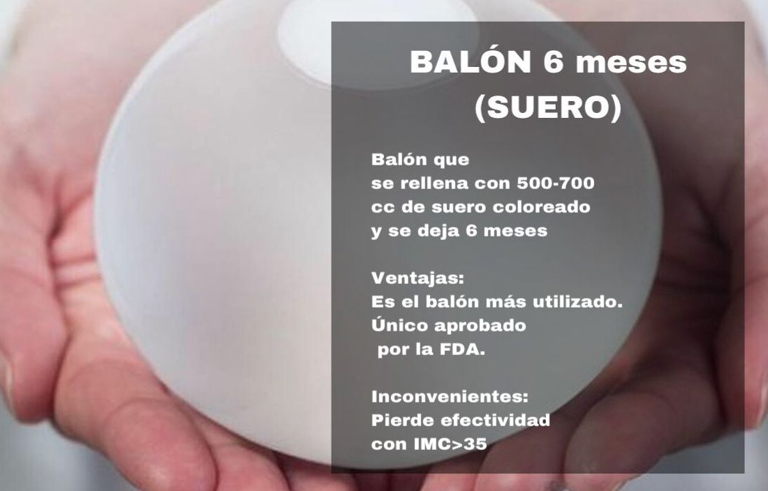 BALÓN INTRAGÁSTRICO: Tratamientos estéticos de Odex Corporación BALÓN INTRAGÁSTRICO: Tratamientos estéticos de Odex Corporación