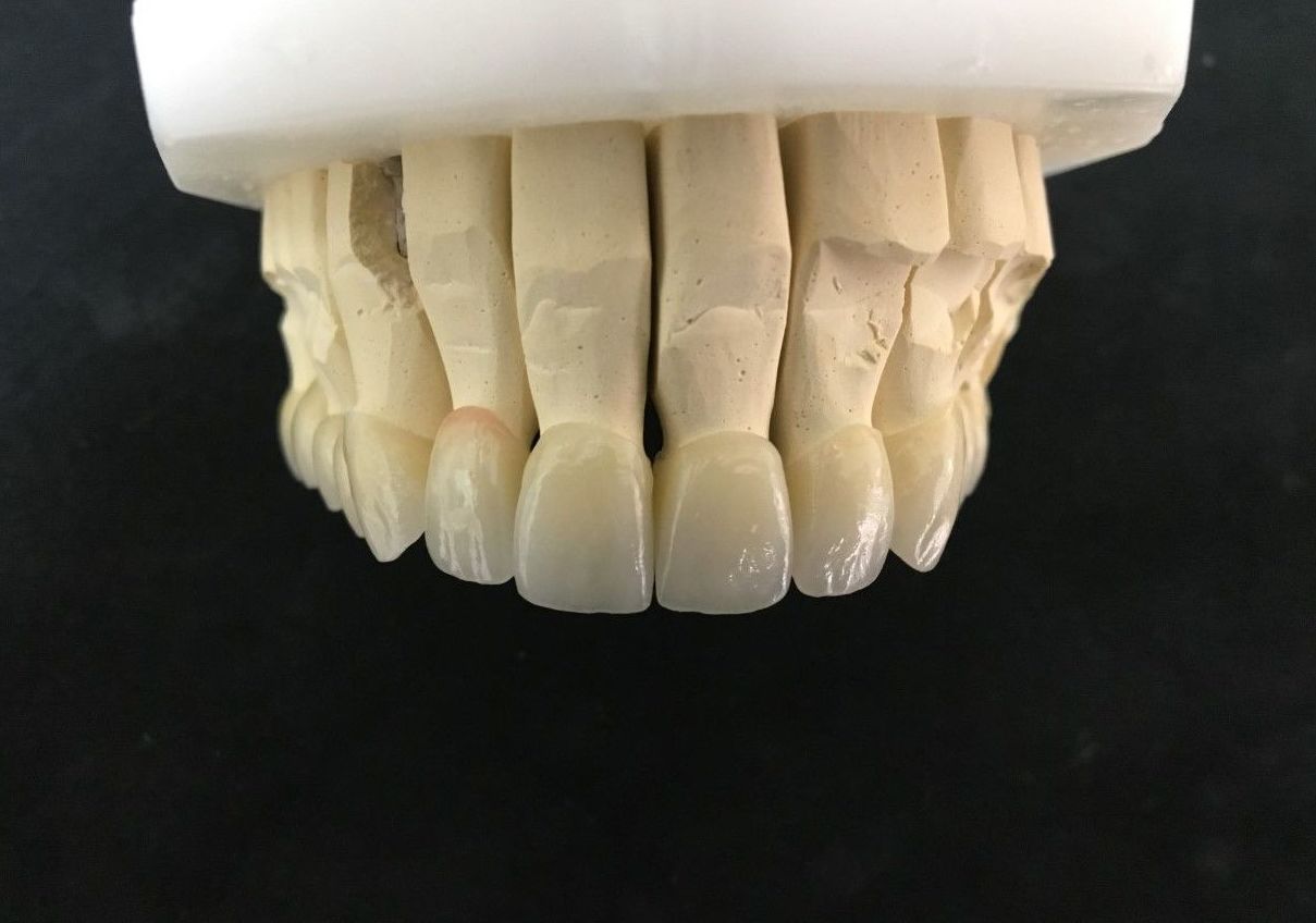 ZIRCONIO: Servicios de Dentallabor Dirks ZIRCONIO: Servicios de Dentallabor Dirks