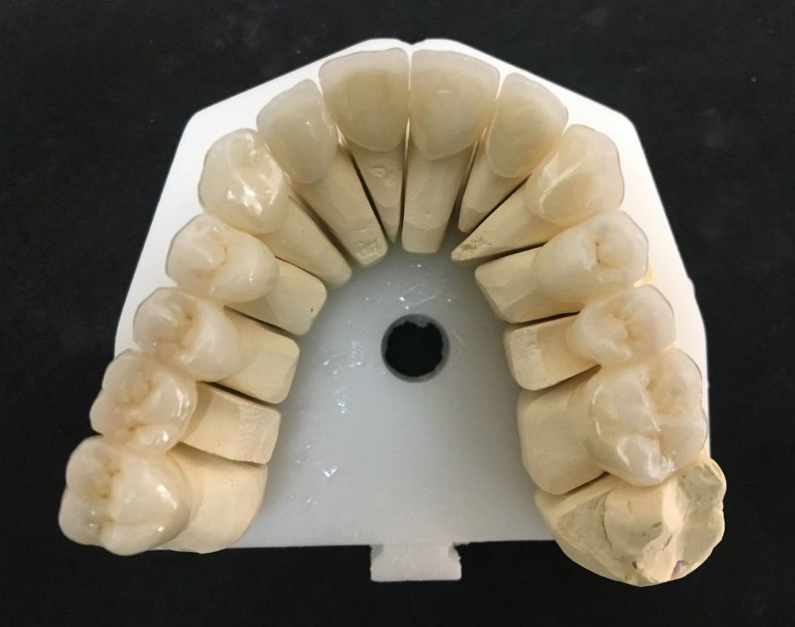 ZIRCONIO: Servicios de Dentallabor Dirks ZIRCONIO: Servicios de Dentallabor Dirks