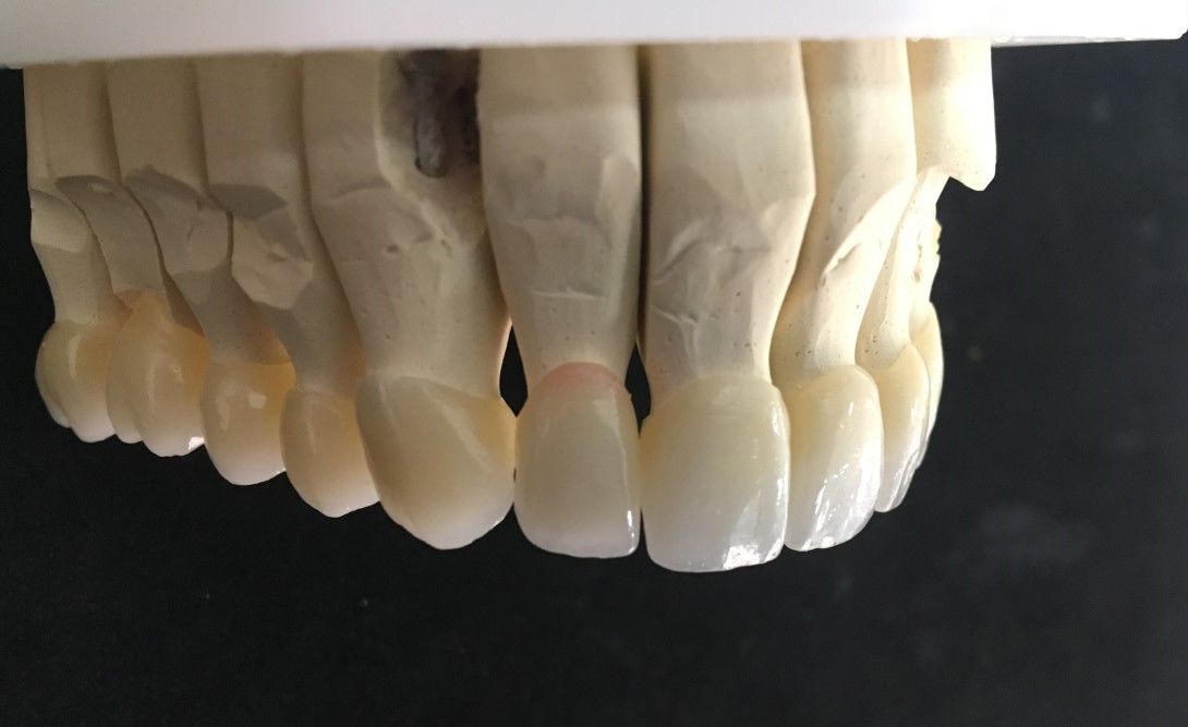 ZIRCONIO: Servicios de Dentallabor Dirks ZIRCONIO: Servicios de Dentallabor Dirks