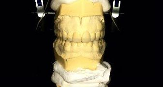 MOCK-UP: Servicios de Dentallabor Dirks MOCK-UP: Servicios de Dentallabor Dirks