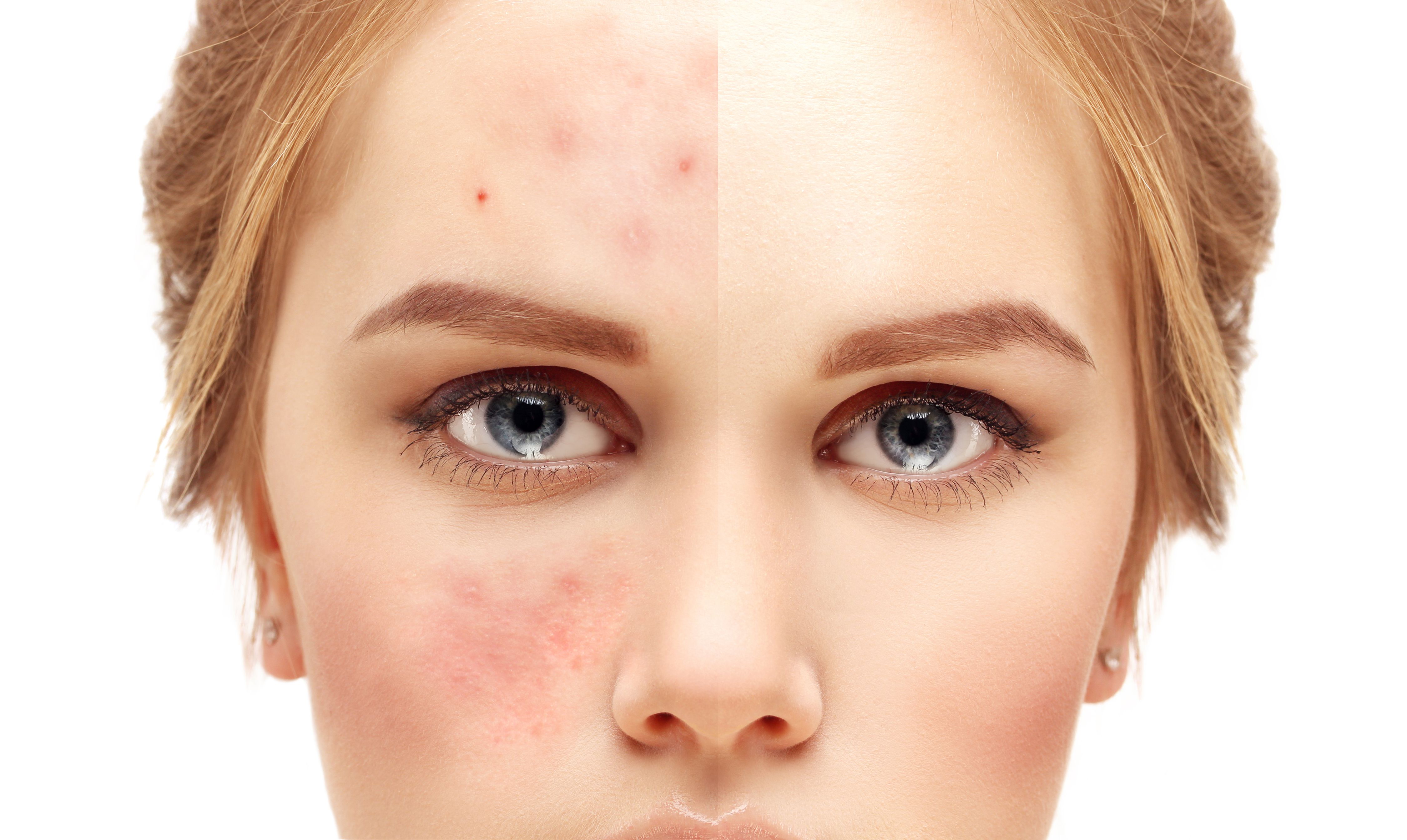 Tratamientos para manchas y cicatrices: Nuestros servicios de Estética Aloe Tratamientos para manchas y cicatrices: Nuestros servicios de Estética Aloe