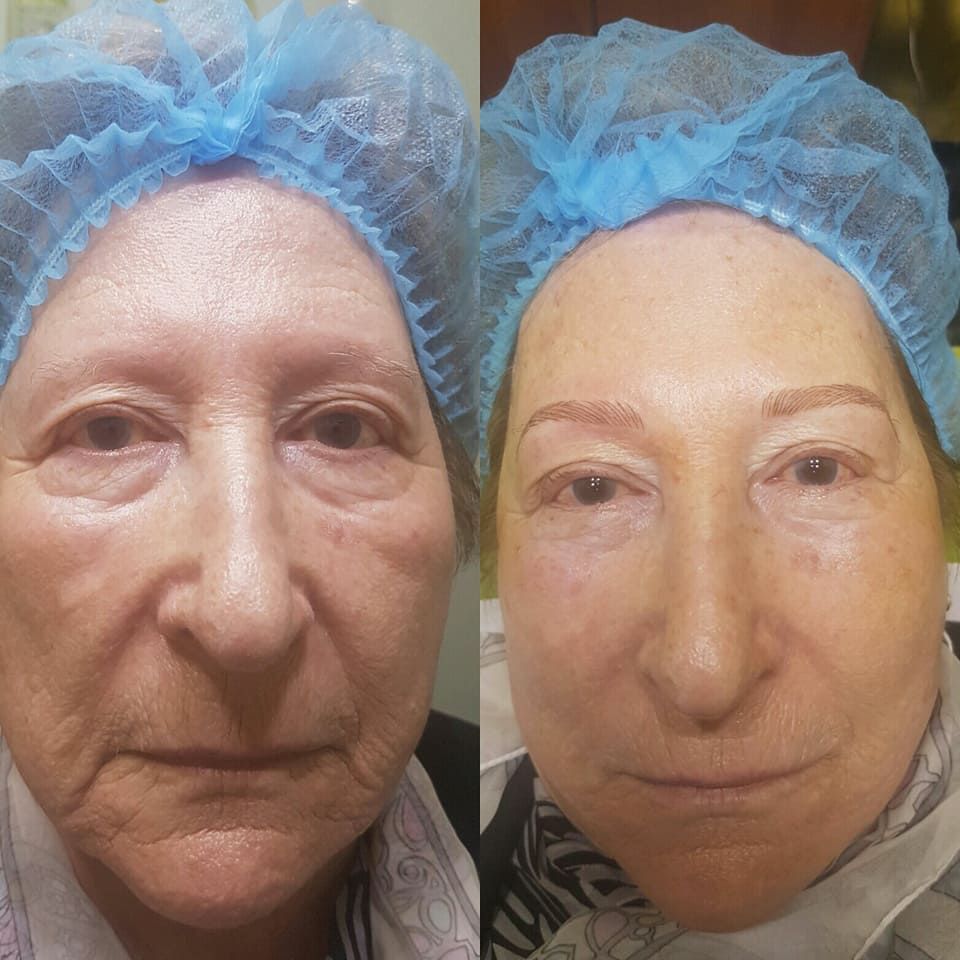 Microblading: Nuestros servicios de Estética Aloe Microblading: Nuestros servicios de Estética Aloe