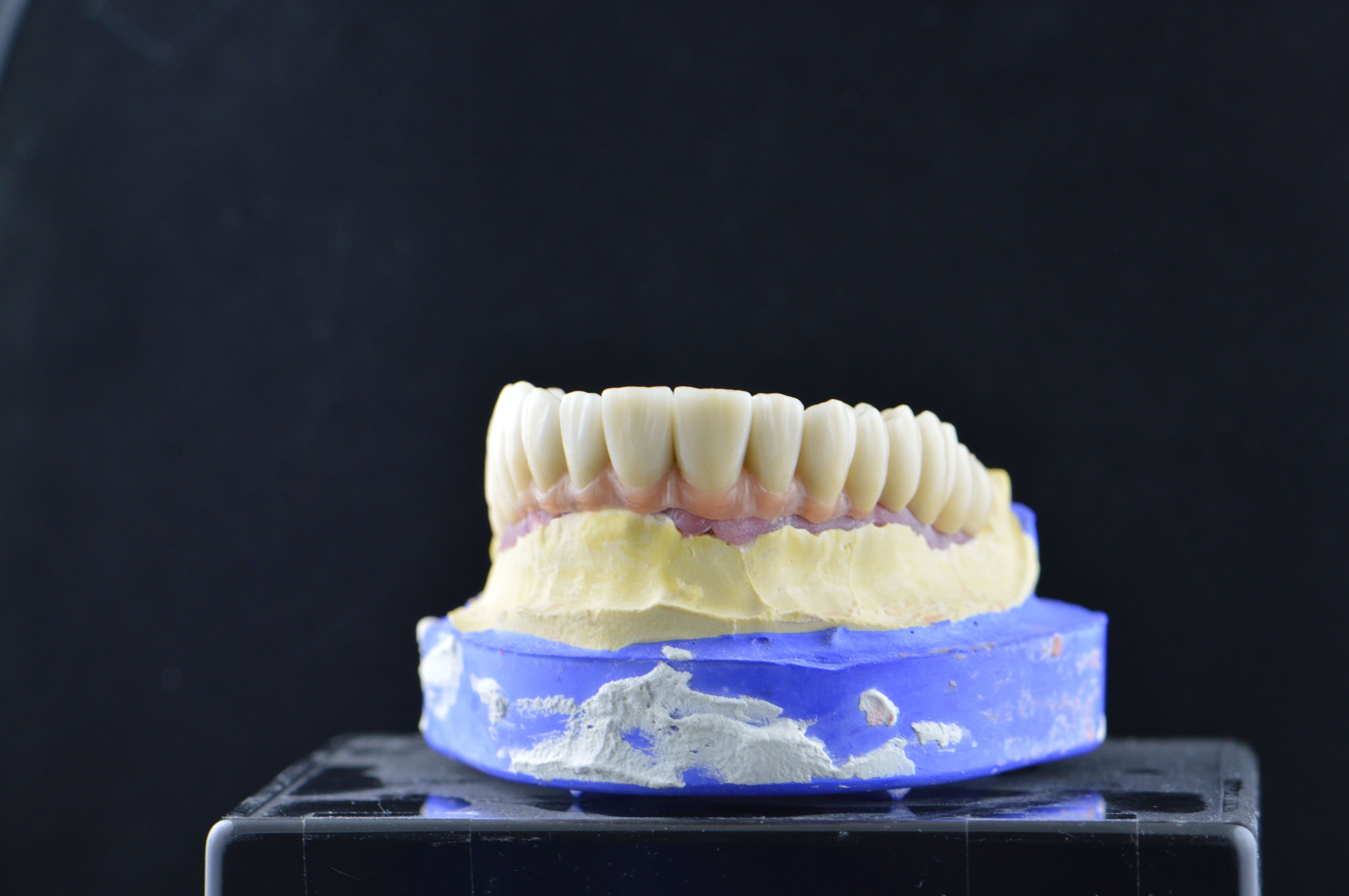 Prótesis fija: Productos y servicios de Tecnolab Dental Galicia Prótesis fija: Productos y servicios de Tecnolab Dental Galicia