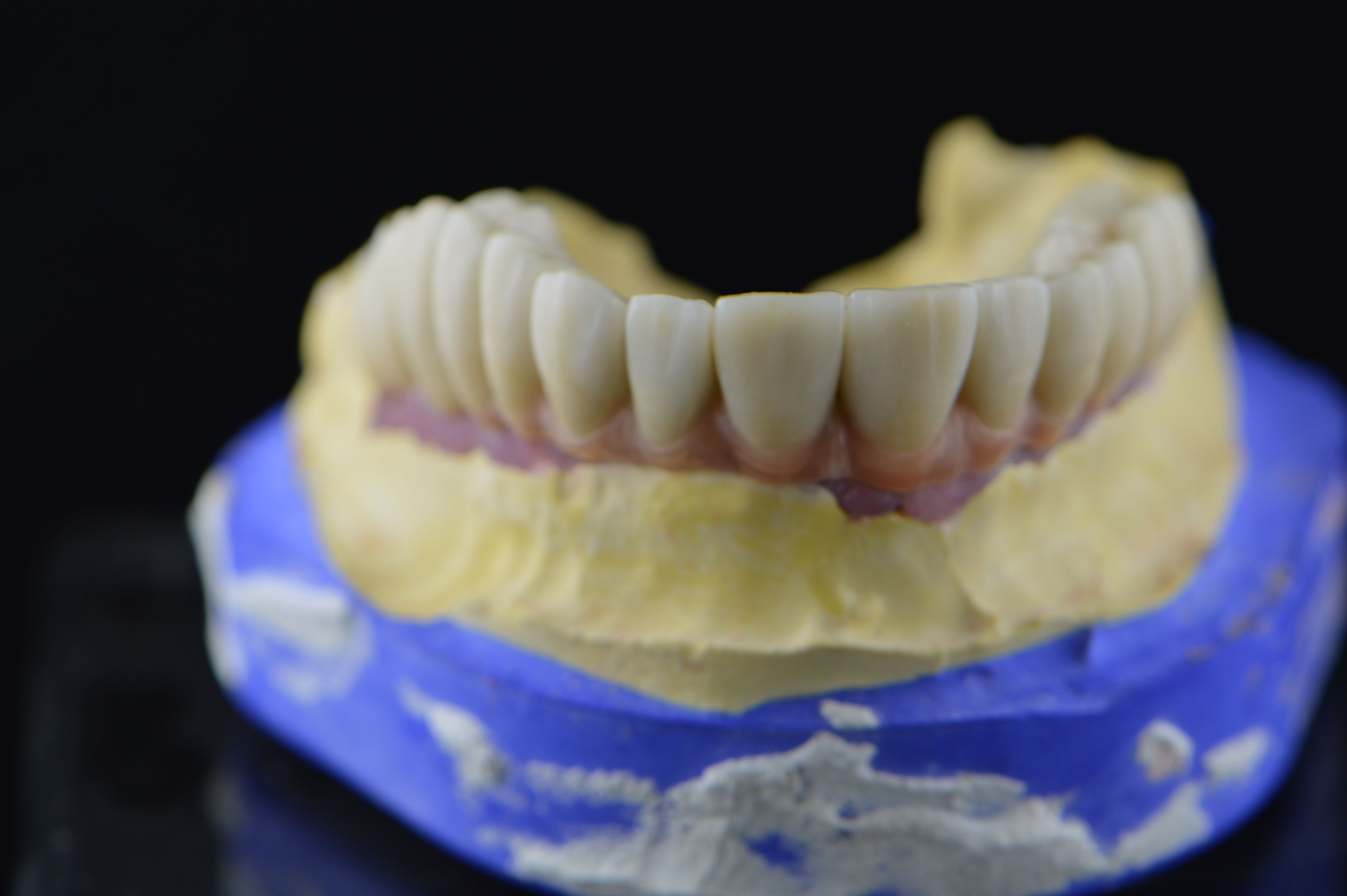 Prótesis dentales: Productos y servicios de Tecnolab Dental Galicia Prótesis dentales: Productos y servicios de Tecnolab Dental Galicia
