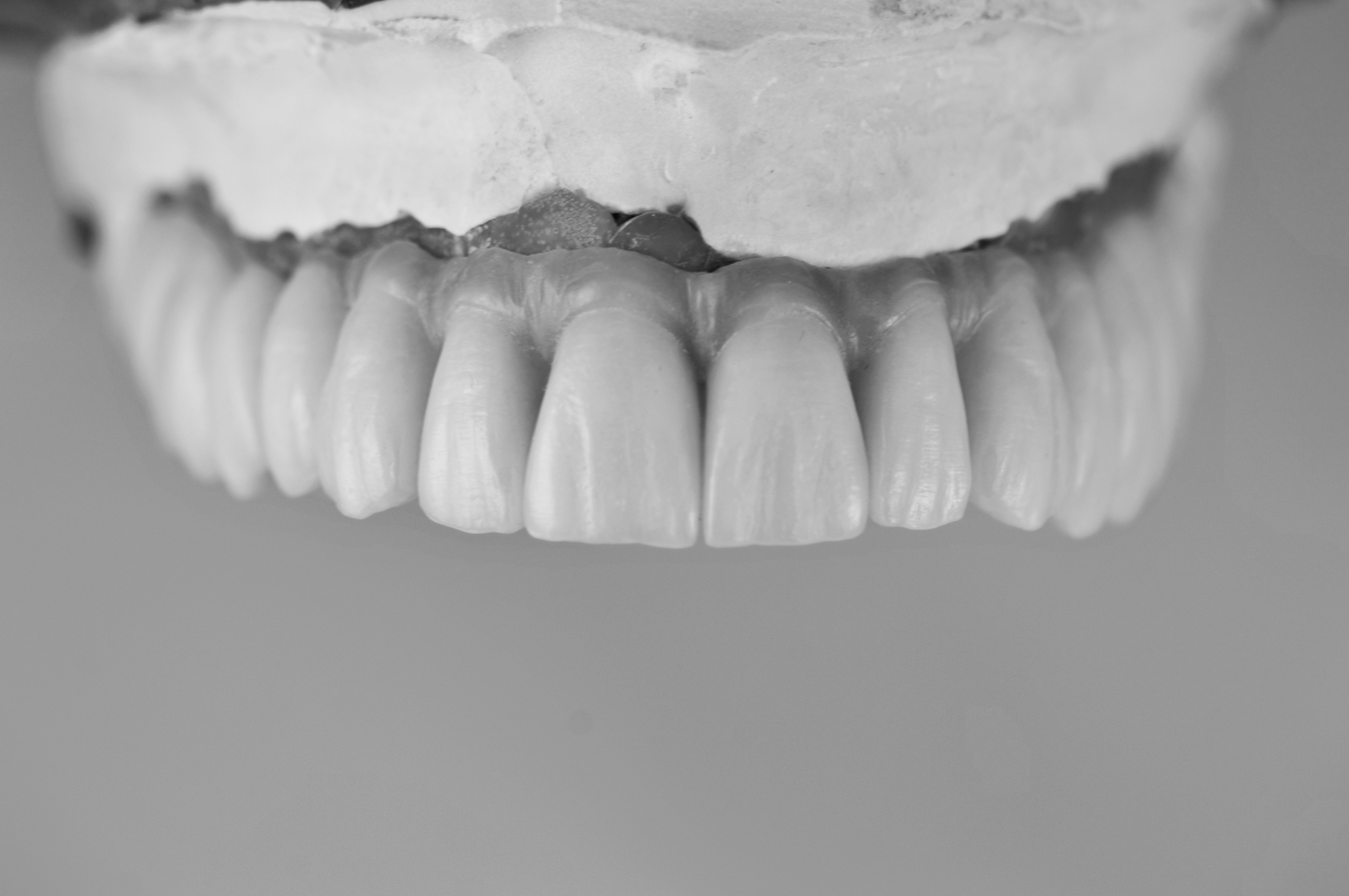 Prótesis fija: Productos y servicios de Tecnolab Dental Galicia Prótesis fija: Productos y servicios de Tecnolab Dental Galicia