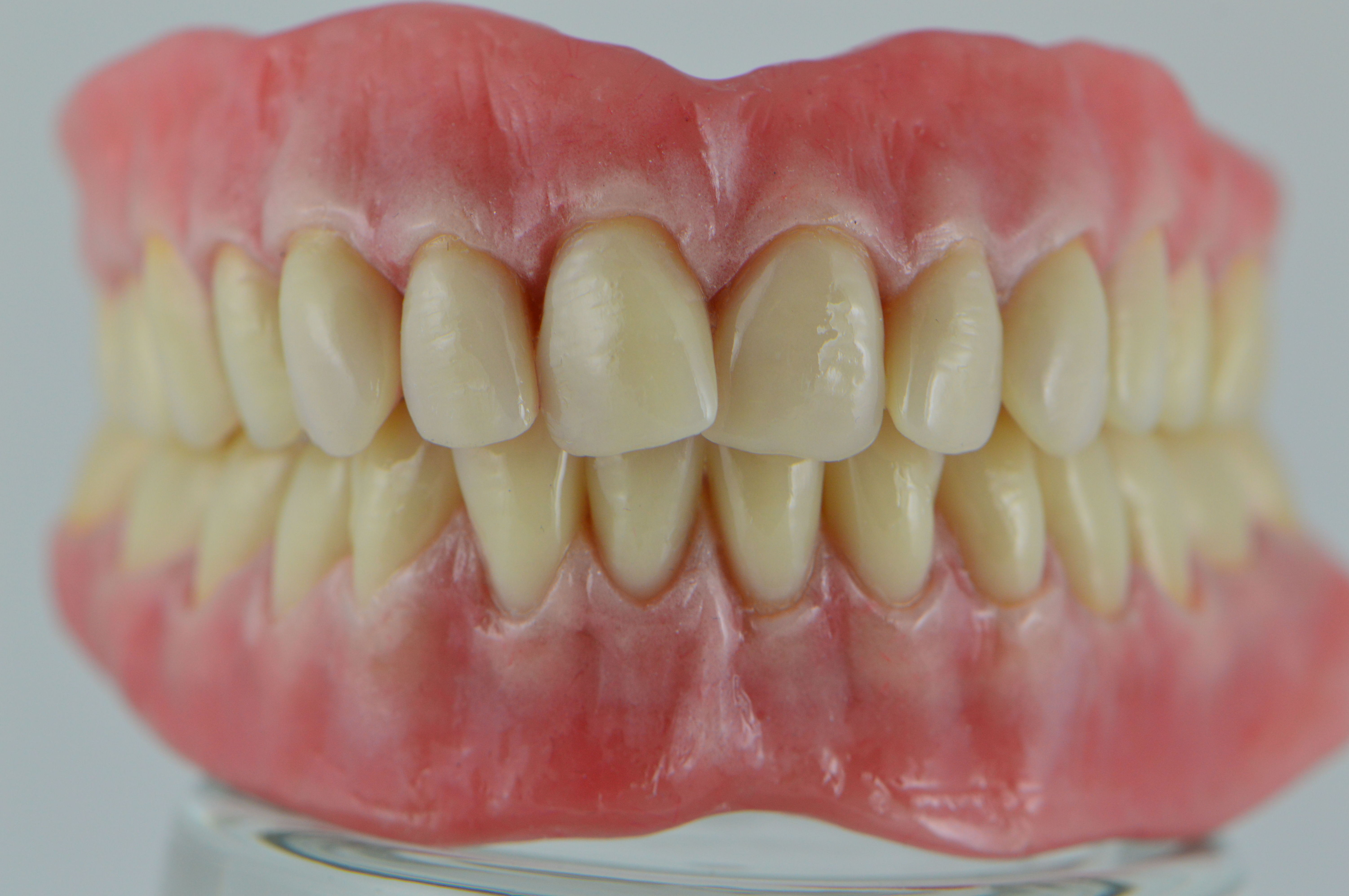 Prótesis removible: Productos y servicios de Tecnolab Dental Galicia Prótesis removible: Productos y servicios de Tecnolab Dental Galicia