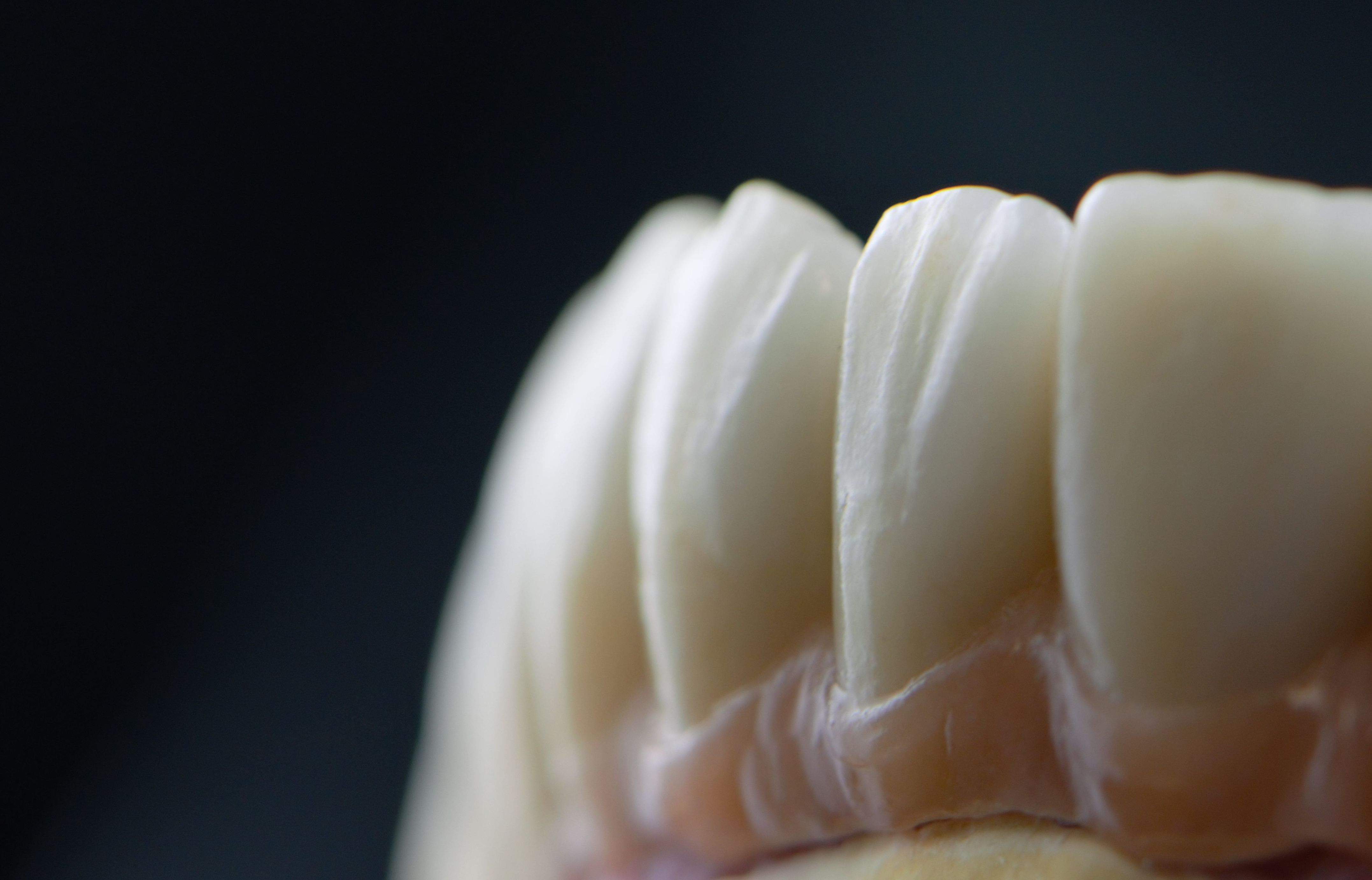 Prótesis fija: Productos y servicios de Tecnolab Dental Galicia Prótesis fija: Productos y servicios de Tecnolab Dental Galicia