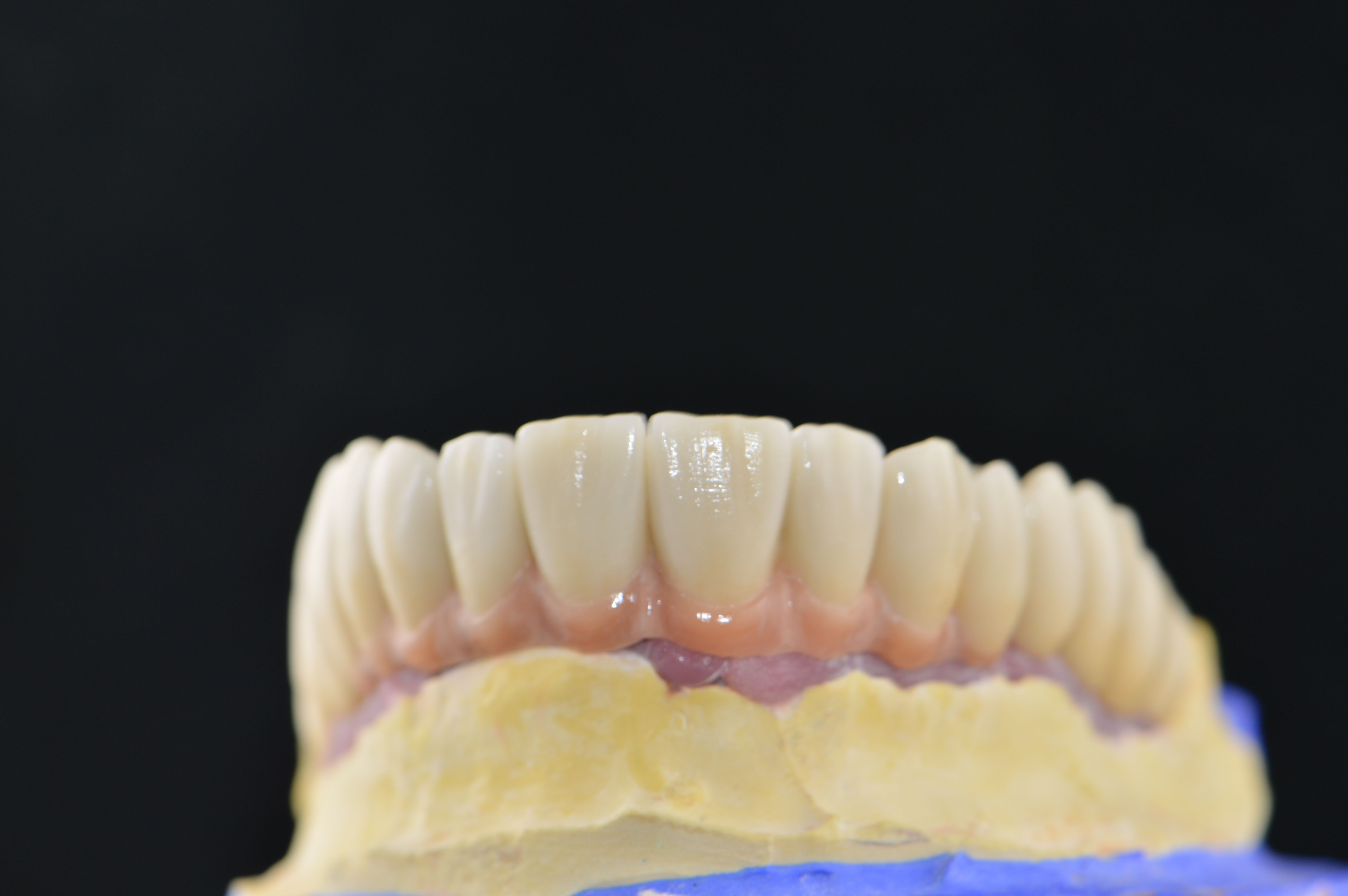 Prótesis dentales: Productos y servicios de Tecnolab Dental Galicia Prótesis dentales: Productos y servicios de Tecnolab Dental Galicia
