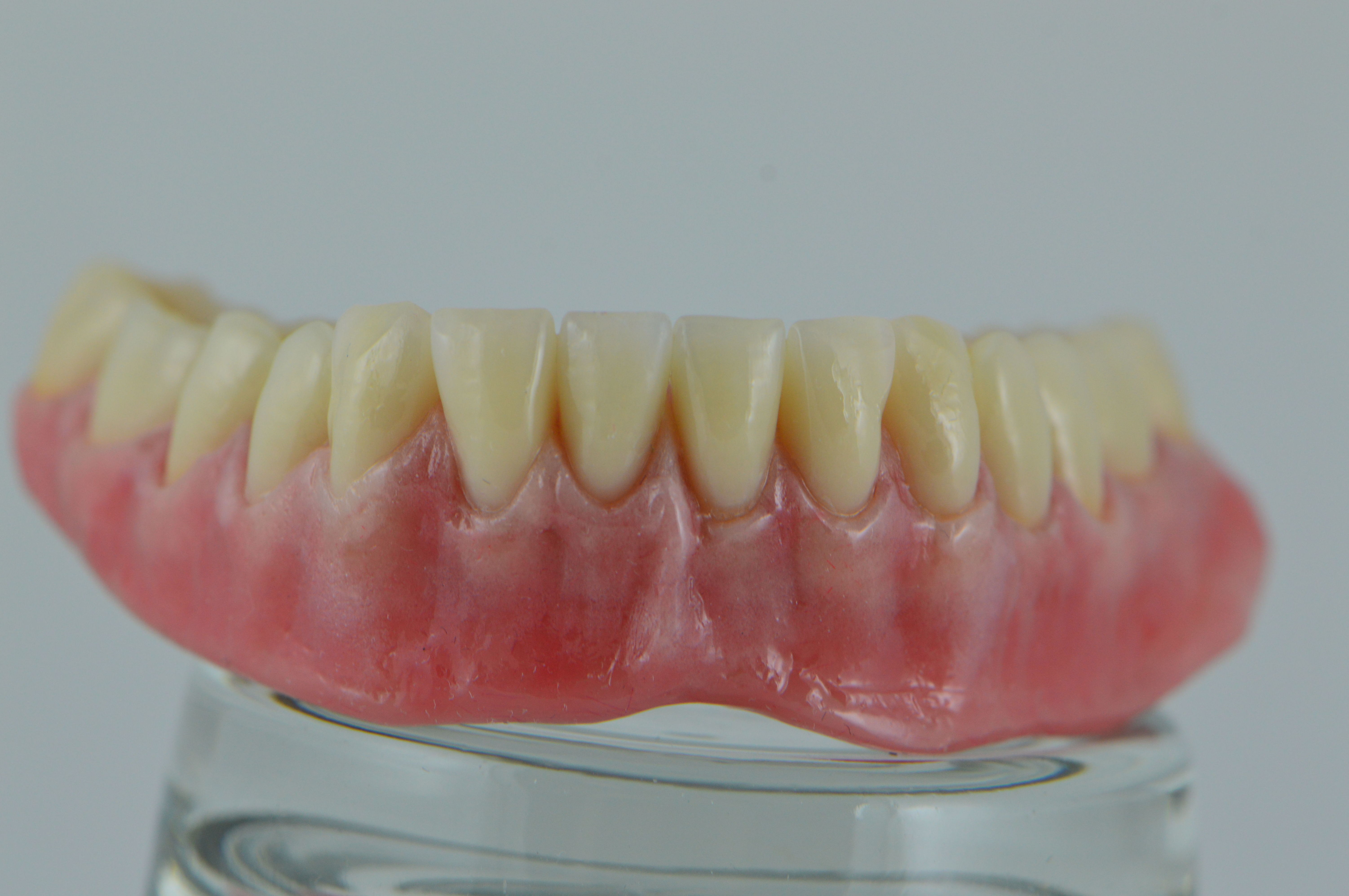 Prótesis removible: Productos y servicios de Tecnolab Dental Galicia Prótesis removible: Productos y servicios de Tecnolab Dental Galicia