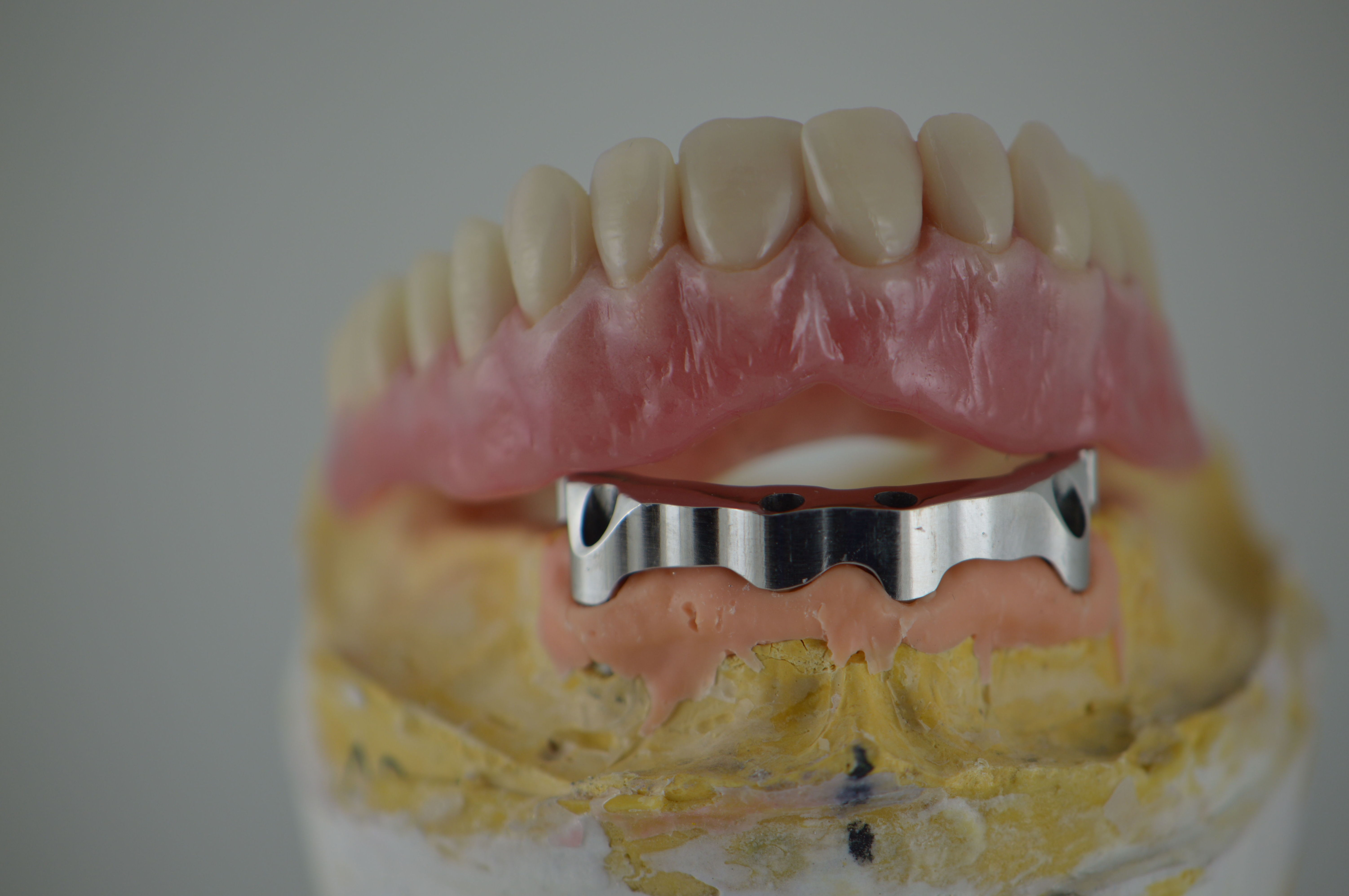 Prótesis removible: Productos y servicios de Tecnolab Dental Galicia Prótesis removible: Productos y servicios de Tecnolab Dental Galicia