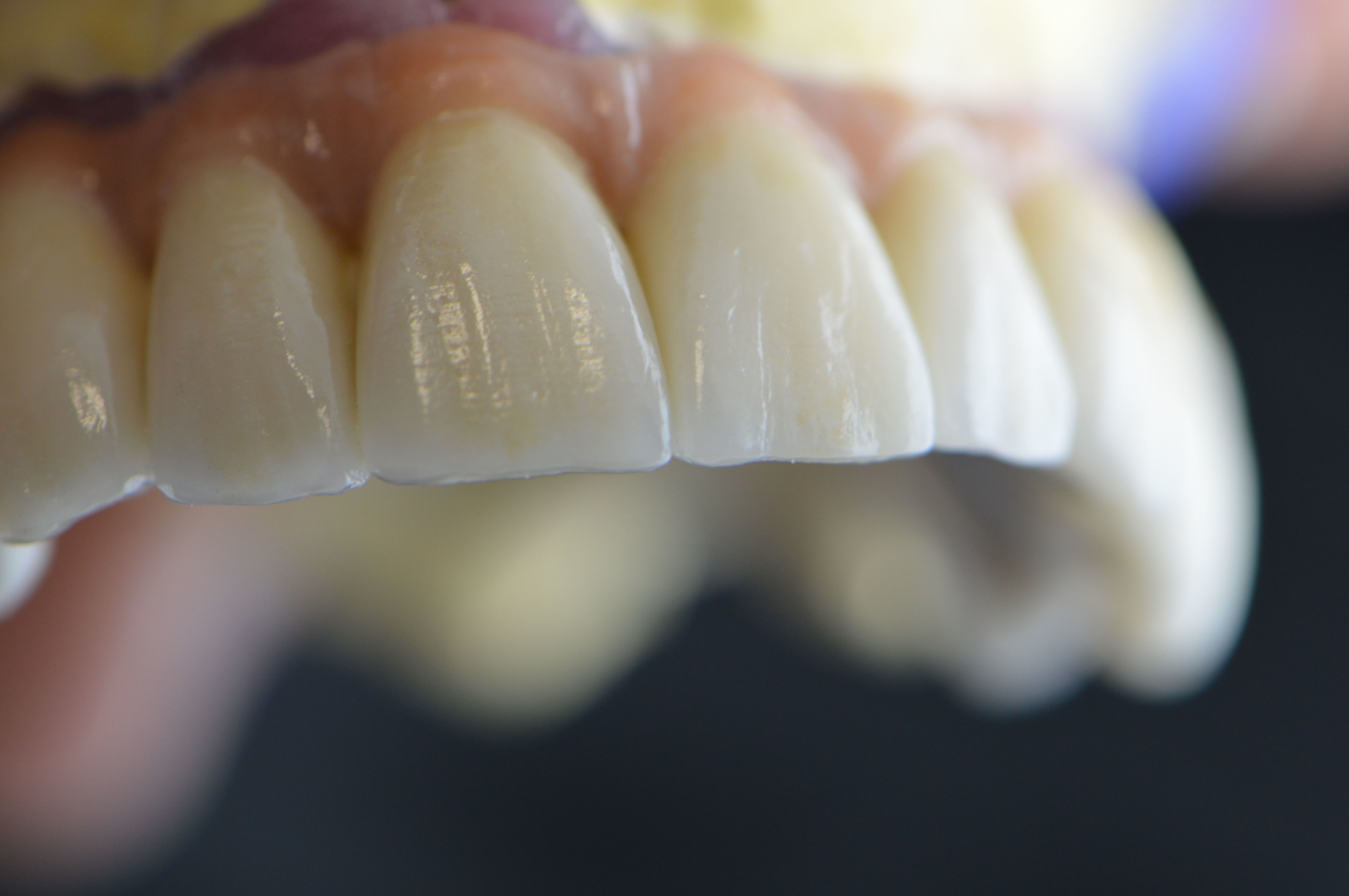 Prótesis fija: Productos y servicios de Tecnolab Dental Galicia Prótesis fija: Productos y servicios de Tecnolab Dental Galicia