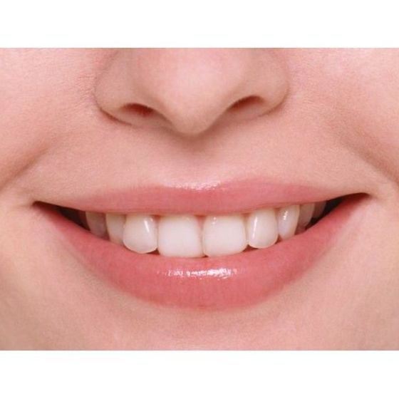 Estética dental: Tratamientos de Clínica Dental Humanes 61 }}