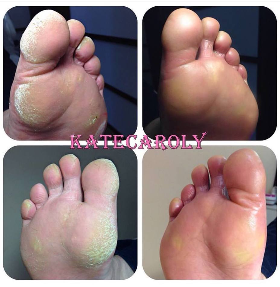 PEDICURA RUSA PERMANENTE: TRATAMIENTOS de Stetic Nails Hello Kitty PEDICURA RUSA PERMANENTE: TRATAMIENTOS de Stetic Nails Hello Kitty