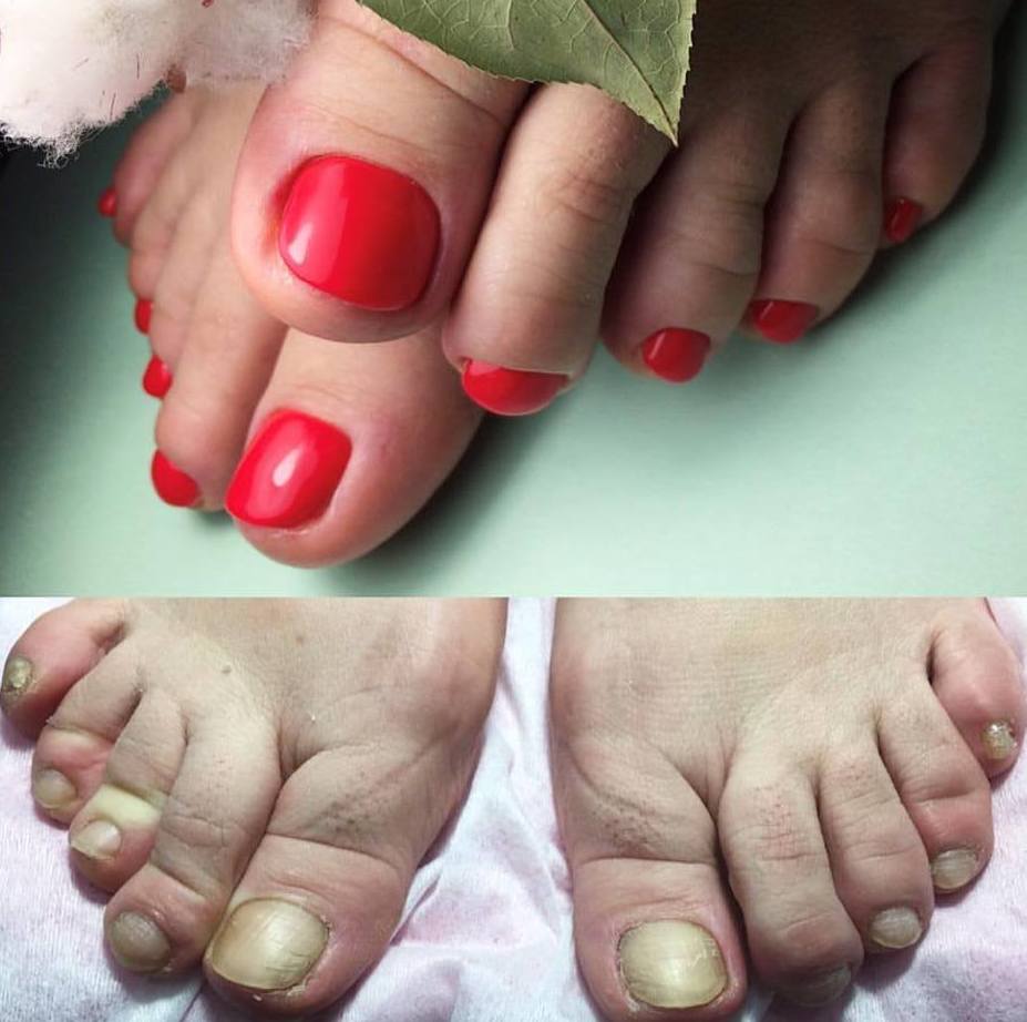 PEDICURA RUSA PERMANENTE: TRATAMIENTOS de Stetic Nails Hello Kitty PEDICURA RUSA PERMANENTE: TRATAMIENTOS de Stetic Nails Hello Kitty