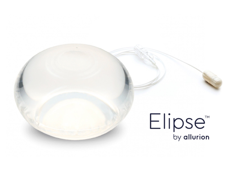 Balón Gástrico ELIPSE: Tratamientos de Dr. Felipe Bárcenas Balón Gástrico ELIPSE: Tratamientos de Dr. Felipe Bárcenas