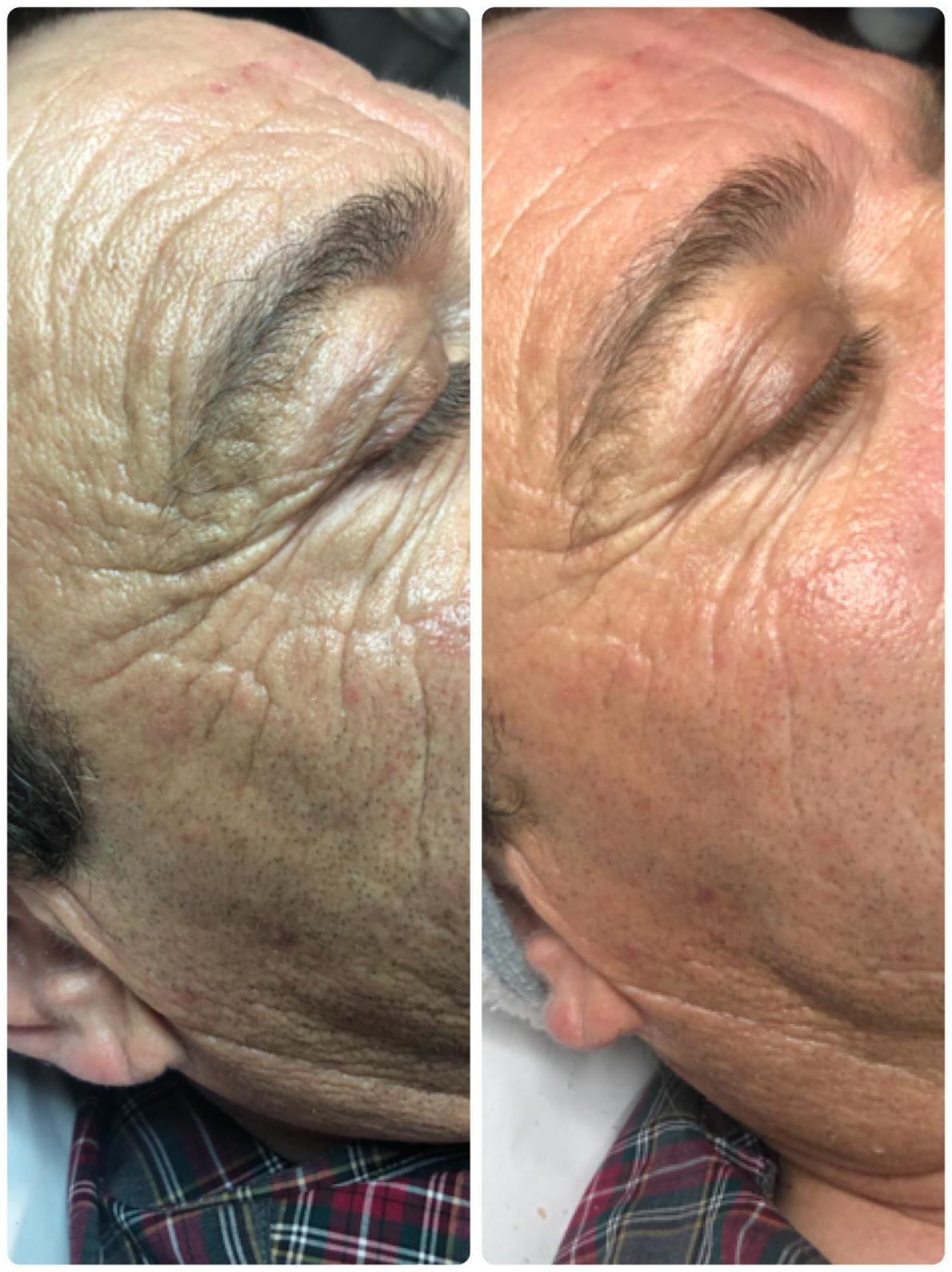 Super Lifting Program: Tratamientos estéticos de Centro de Belleza Venus Super Lifting Program: Tratamientos estéticos de Centro de Belleza Venus