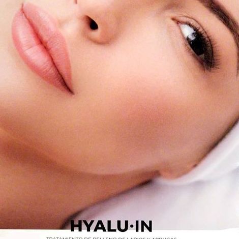 Tratamiento de relleno de labios y arrugas Benicarló Tratamiento de relleno de labios y arrugas Benicarló