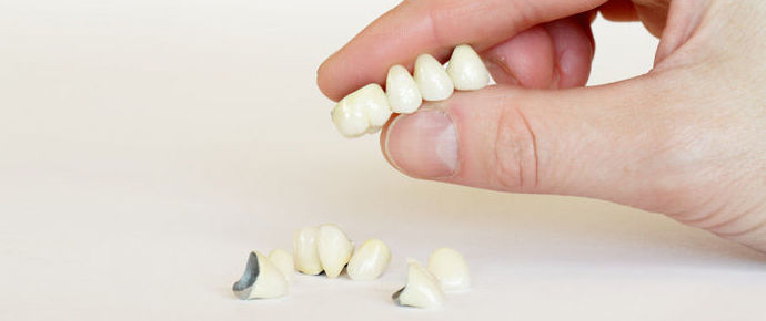 Prótesis: Tratamientos de Clínica Dents Prótesis: Tratamientos de Clínica Dents