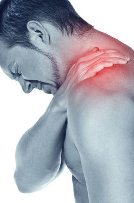 Lesiones frecuentes en Osteopatía: NEURALGIA CERVICOBRAQUIAL "CIÁTICA DE HOMBRO"
