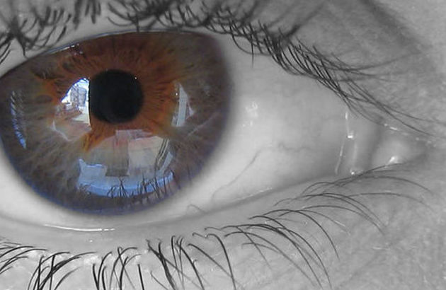 Degeneración Macular (Acupuntura): Tratamientos & Tarifas de Centro de Recuperación Física Lotería 2 Casco Viejo Degeneración Macular (Acupuntura): Tratamientos & Tarifas de Centro de Recuperación Física Lotería 2 Casco Viejo