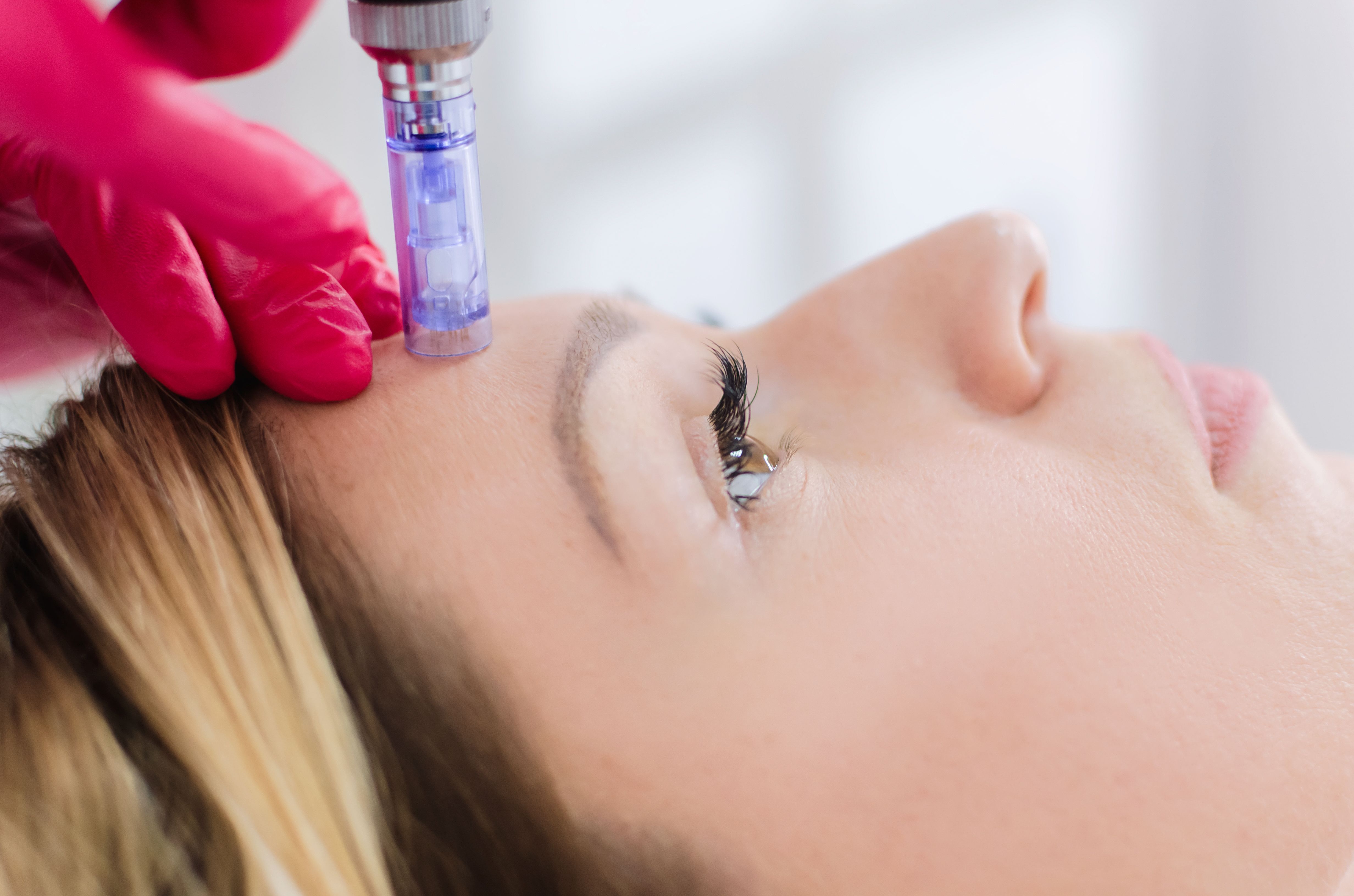 Microdermoabrasión por punta de diamante: Servicios de Salón de Belleza Hebrón SL Microdermoabrasión por punta de diamante: Servicios de Salón de Belleza Hebrón SL
