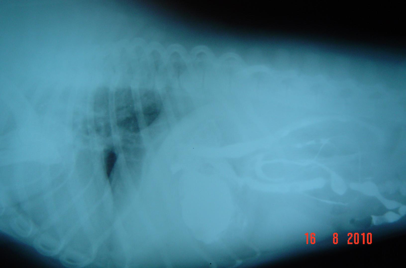 X-rays X-rays