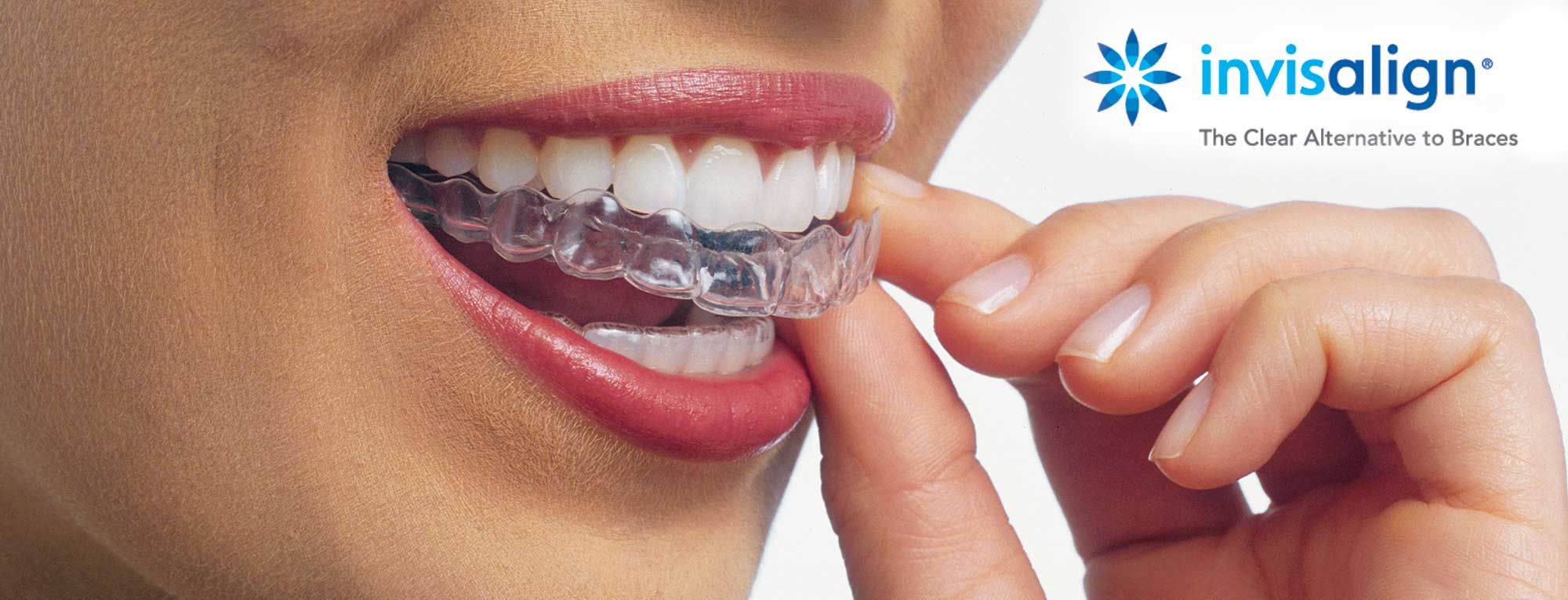 Ortodoncia: Tratamientos de Dental Valls Ortodoncia: Tratamientos de Dental Valls