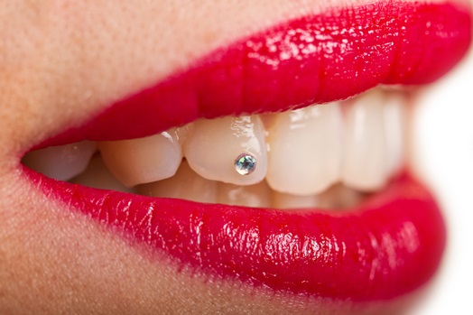 Estética dental: Tratamientos de Dental Valls Estética dental: Tratamientos de Dental Valls