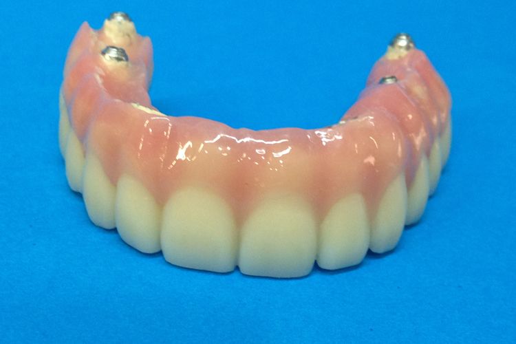 Especialistas en prótesis dental