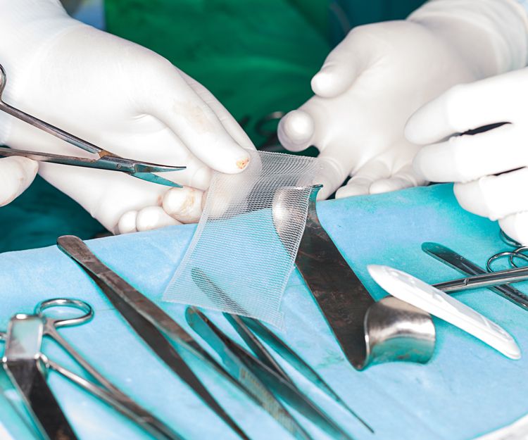 Infección de malla tras hernioplastia: Patologías y Tratamientos de Dra. Gutiérrez Moreno Infección de malla tras hernioplastia: Patologías y Tratamientos de Dra. Gutiérrez Moreno