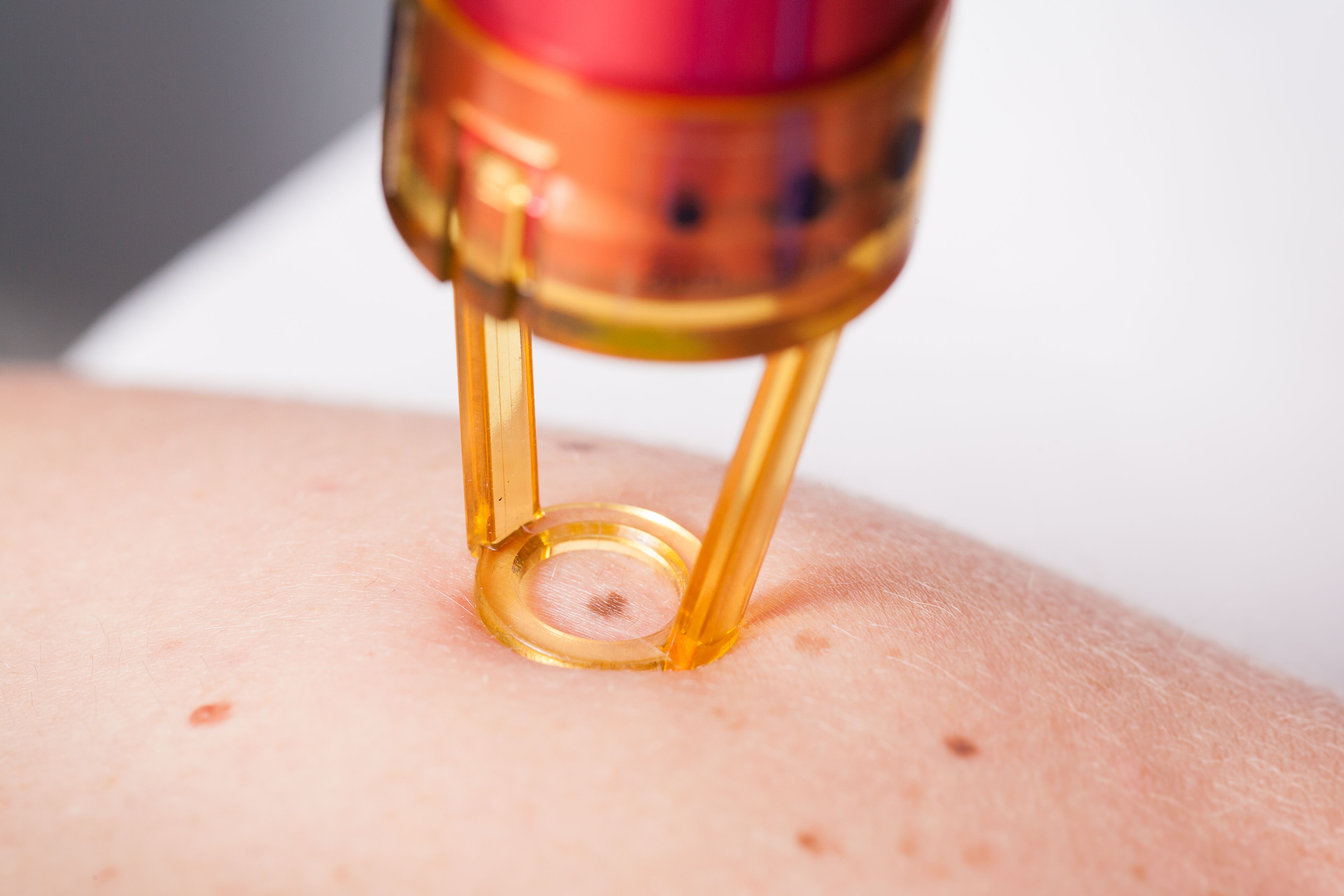Dermatología pediátrica y de adultos: Servicios de Pujol Montcusí. Dr. Dermatología pediátrica y de adultos: Servicios de Pujol Montcusí. Dr.