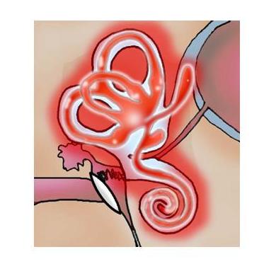 El vértigo: Técnicas de Clínica de Otorrinolaringología El vértigo: Técnicas de Clínica de Otorrinolaringología